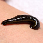 seminar-aschner-ausleitungs-verfahren-health-horizon-wiesbaden